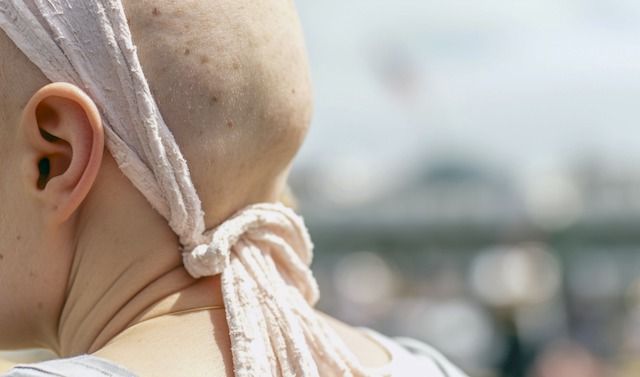 Donna malata di tumore in un'immagine di repertorio